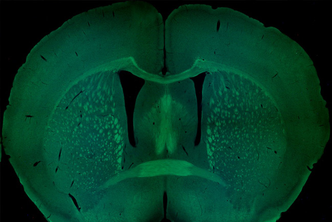 Coronal section of a mouse brain, with several major axonal tracts stained in green.