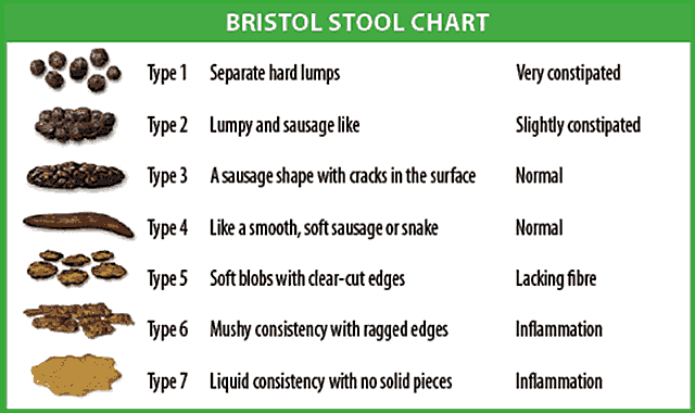 Chart illustrating different stool consistancies that reads: Type 1 - Separate hard lumps - Very constipated | Type 2 - Lumpy and sausage like - slightly constipated | Type 3 -A sausage shape with cracks in the surface - Normal | Type 4 - Like a smooth, soft sausage or snake - Normal | Type 5 - Soft blobs with clear-cut edges - Lacking fibre | Type 6 - Mushy consistency with ragged edges - Inflammation | Type 7 - Liquid consistency with no solid pieces - Inflammation