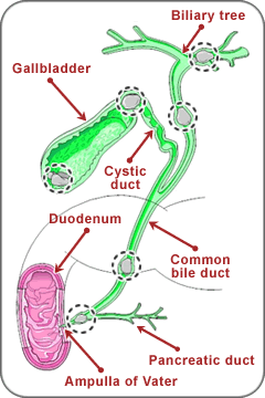 Illustration with the following labels: Billiary tree, Gallbladder, Cystic duct, Duodenum, Common bile duct, Amulla of Vater, and Pancreatic duct.