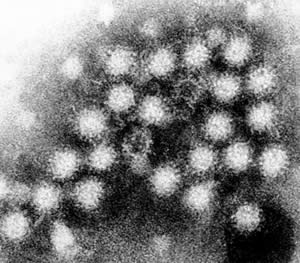 Transmission electron micrograph of norovirus particles in feces.