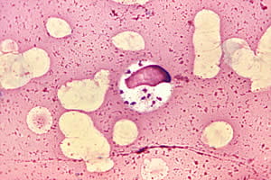 A species of protozoa in a bone marrow cell.