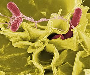 Color-enhanced scanning electron micrograph showing Salmonella Typhimurium (red) invading cultured human cells.
