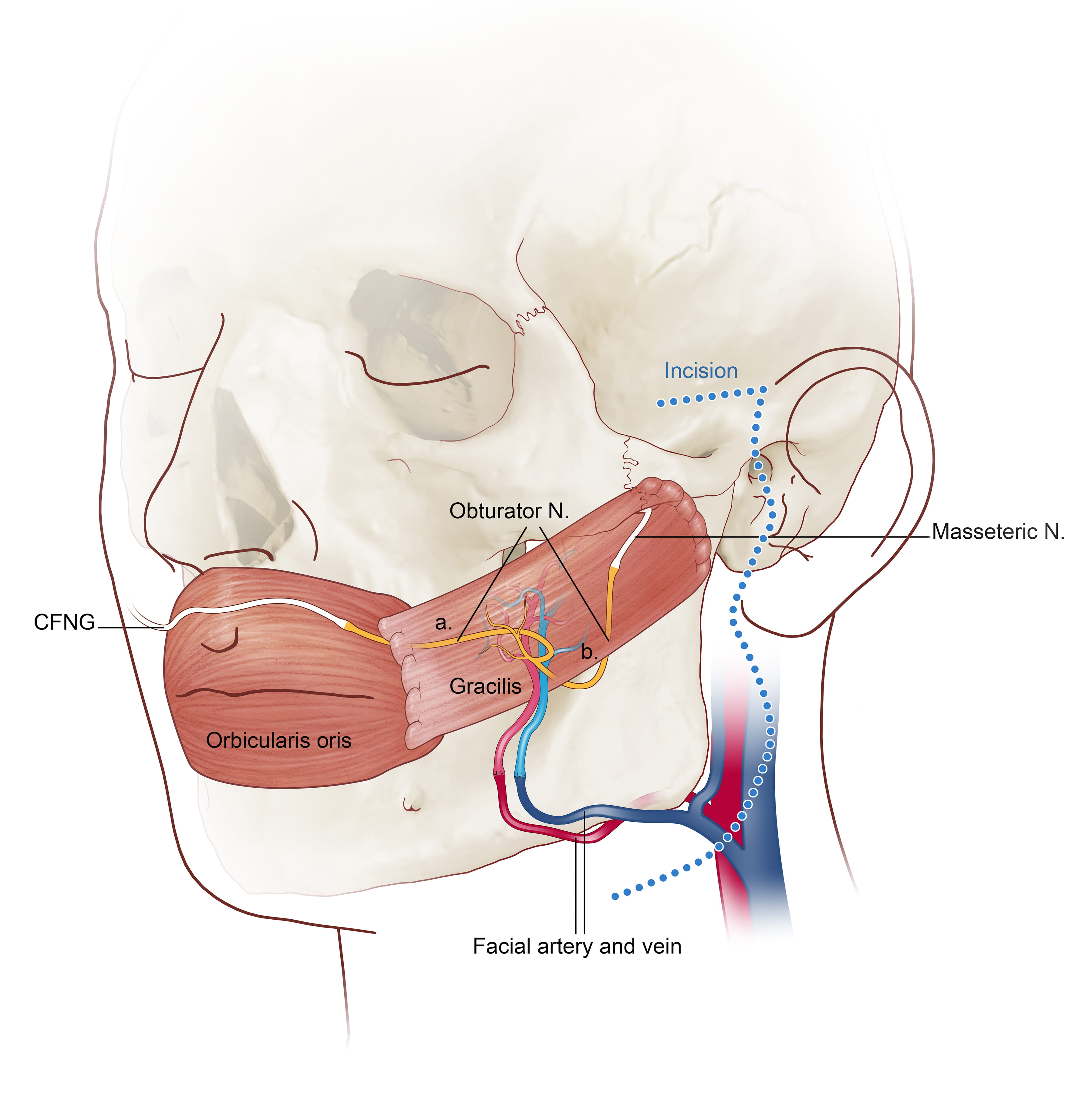 Facial Paralysis MUSC Health Charleston SC