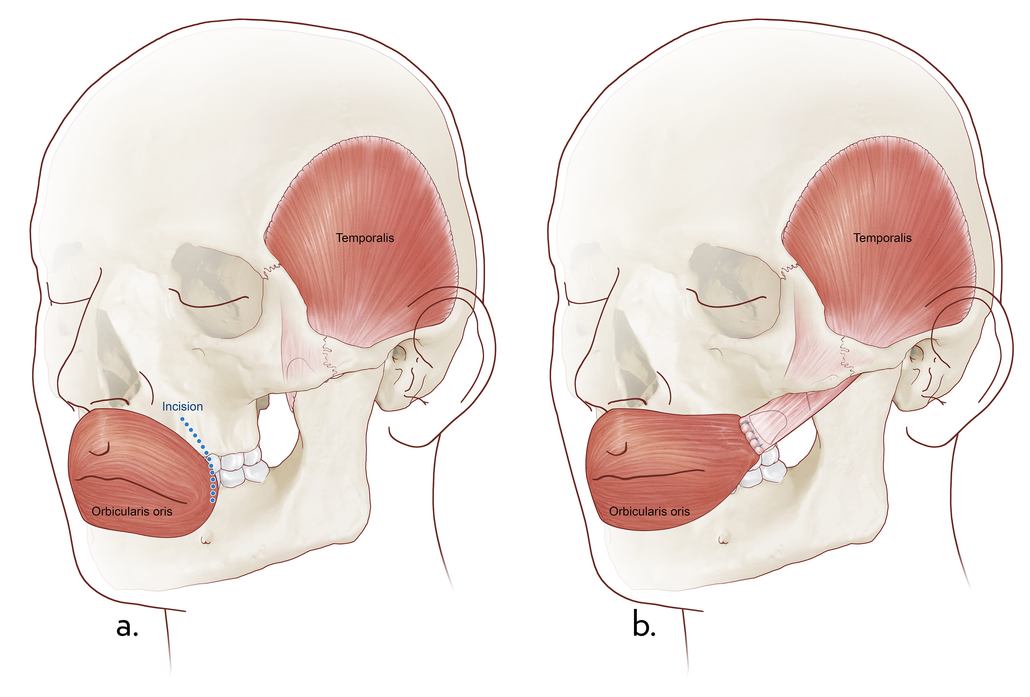 Facial Paralysis MUSC Health Charleston SC