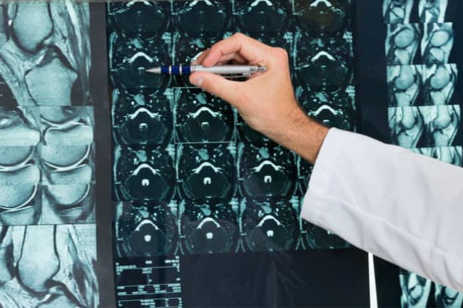 Radiologist examining patient x-ray.