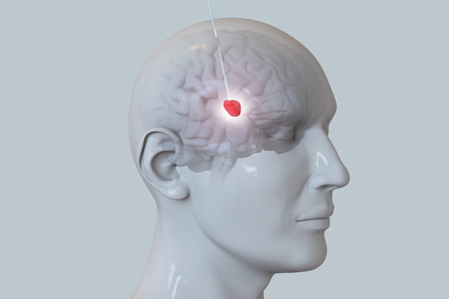 Does Using Temperature Gun Damage The Pineal Gland In The Brain?