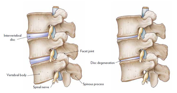 Left lateral view of healthy lumbar vertebrae