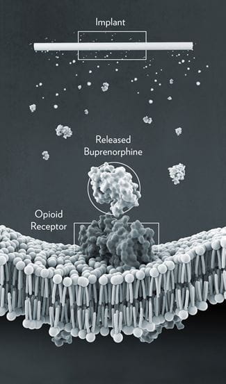 A rendering of buprenorphine being released from the implantable rod and binding to receptors.