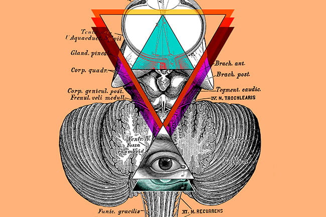 Infographic for the Pineal Cysts Worth a Second Look Progressnotes Article