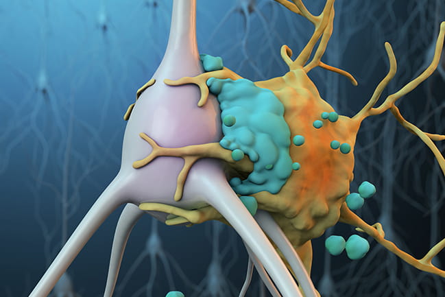 A microglial cell (yellow) attached to an ischemic neuron (gray) that has been tagged by complement proteins (blue)