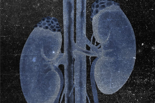 Watercolor image of kidneys