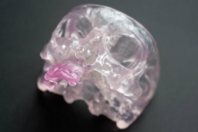 Image of a 3D printed skull showing the right-hand side.