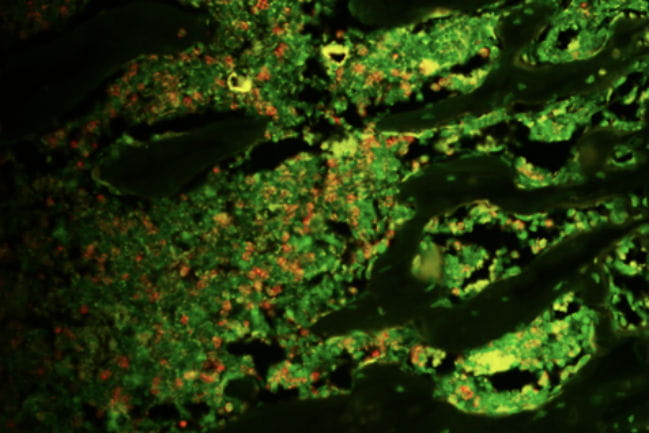 Image showing myeloid-derived suppressor cells the bone marrow of control treated animals.