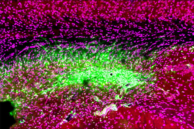 immune cells, neurons, and synapses in pink, red and green under a microscope.