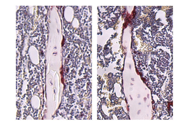 Stained tibiae from germ-free (left) and SFB-mono- associated (right) mice.
