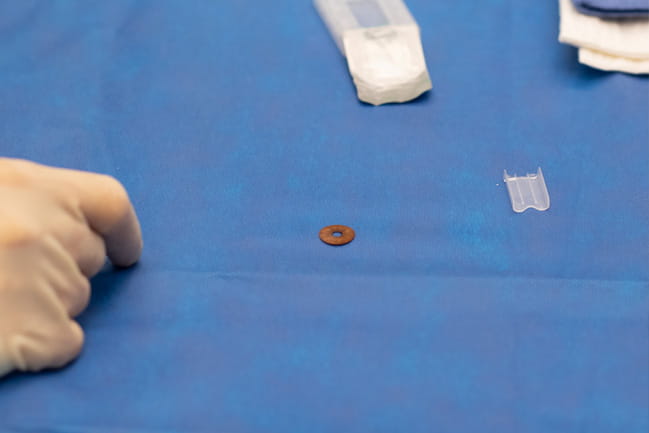 A brown silicone prosthetic iris rests on the table prior to implanting.