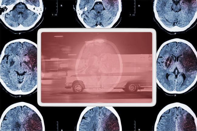 Brain scans surrounding stylized ambulance in motion.