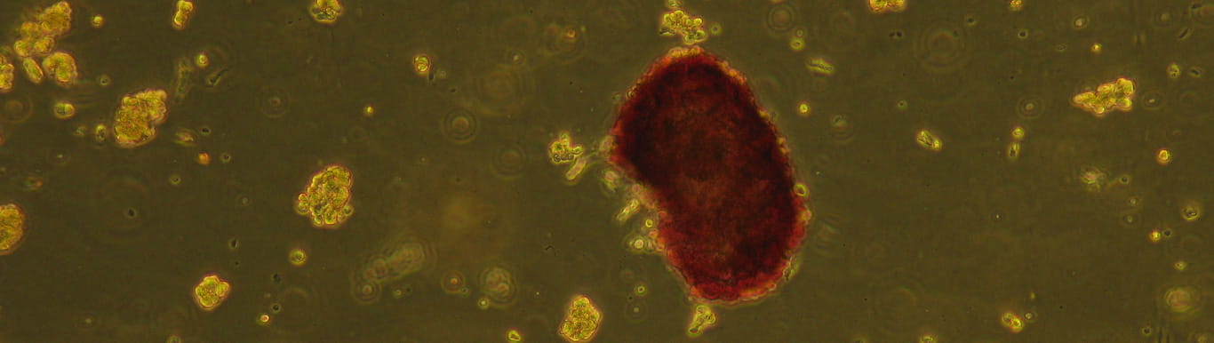  Microscopic image of islet cells in red over a green background.
