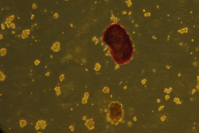  An islet cell in red under a microscope. 