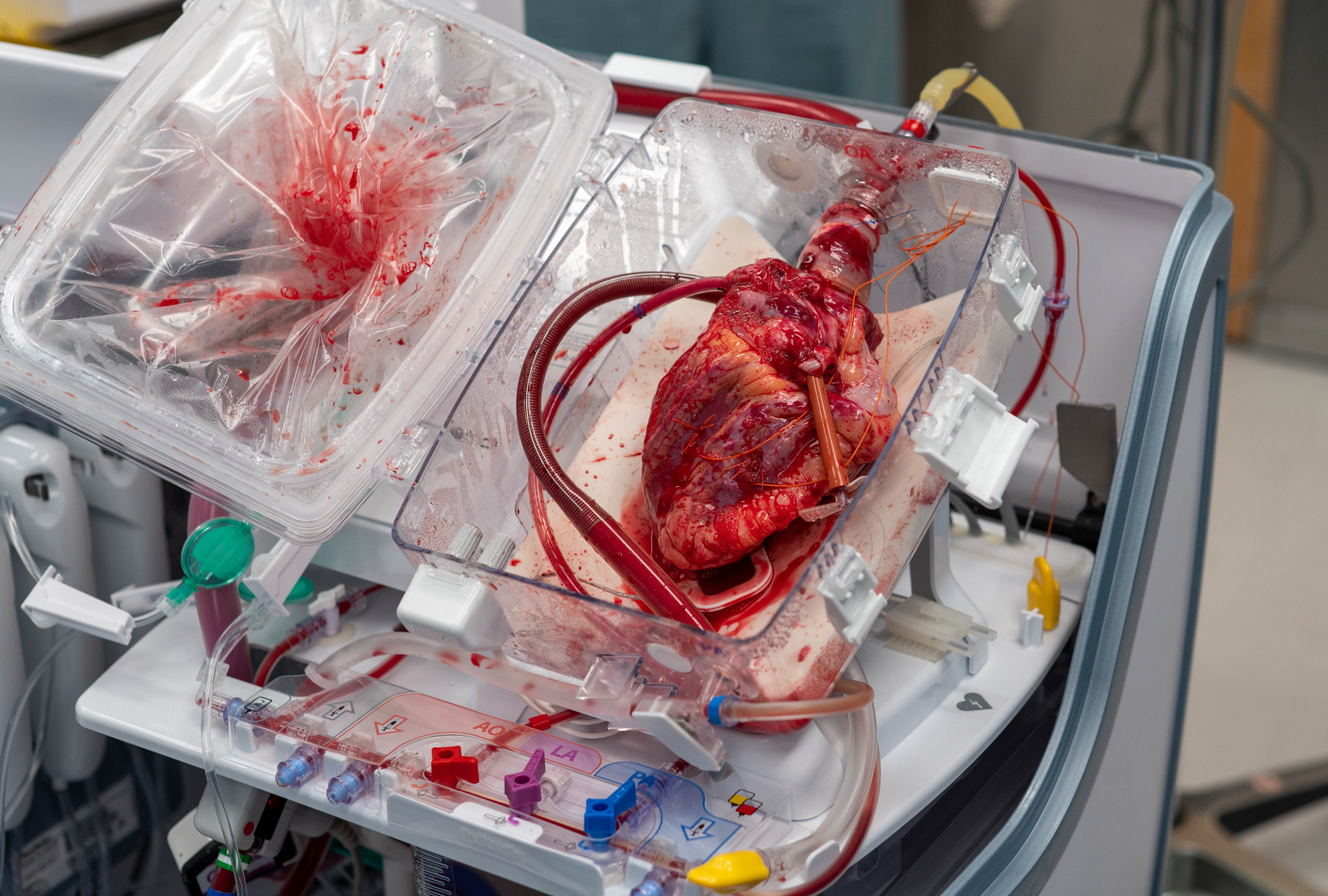 Heart & Vascular Center News, MUSC Health