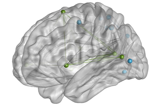 Drawing of brain showing contours and VAN-DAN regions