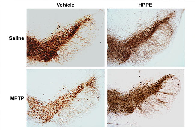 Dopamine producing brain cells (stained brown) were protected with HPPE (right panels) in neurotoxin-based PD model (MPTP; bottom) compared to vehicle control cells (left panels).