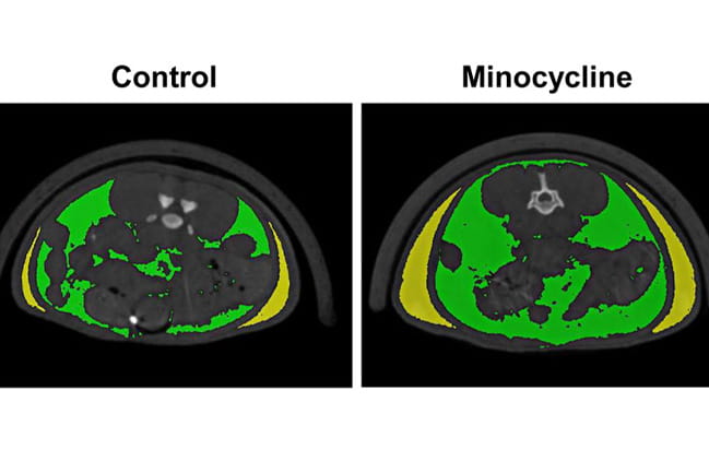 Brain scans. Scan on left reads Control. Scan on right reads Minocycline.