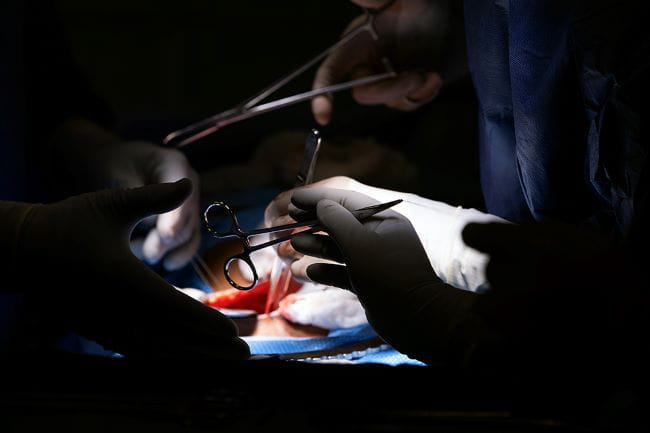 An instrument is passed during a kidney surgery.