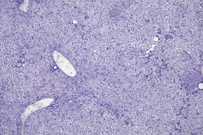 close up of healthy liver cells in mouse model