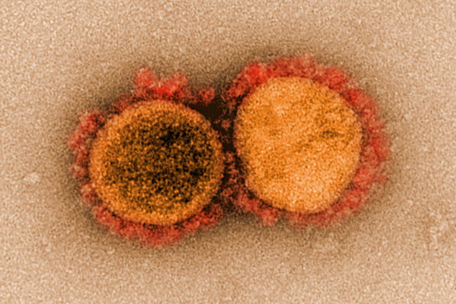 two orange virus particles under a microscope