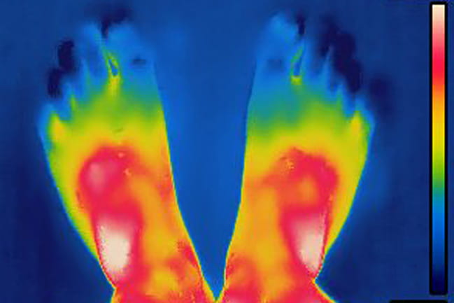 Infrared image showing temperature changes in feet and lower legs