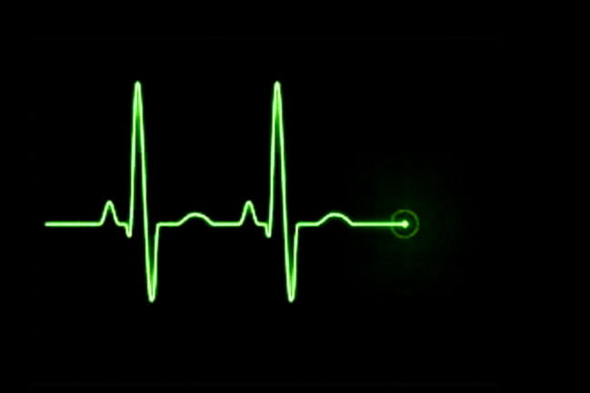 picture of heartbeat on a monitor