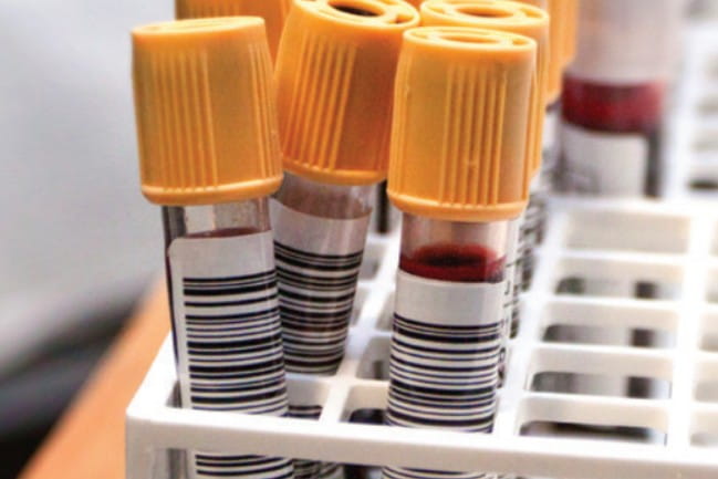 Blood samples in specimen tubes