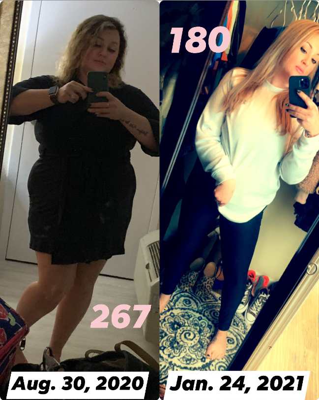 Before and after photos of bariatric surgery patient Stephanie