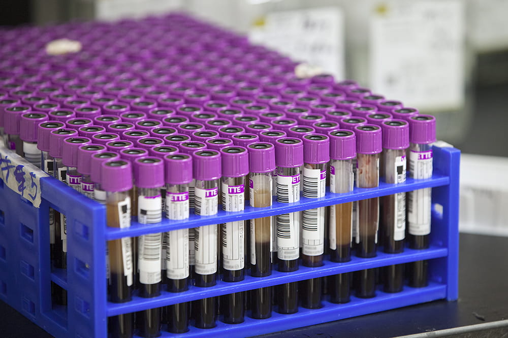 MUSC tests Blood Connection donors for coronavirus