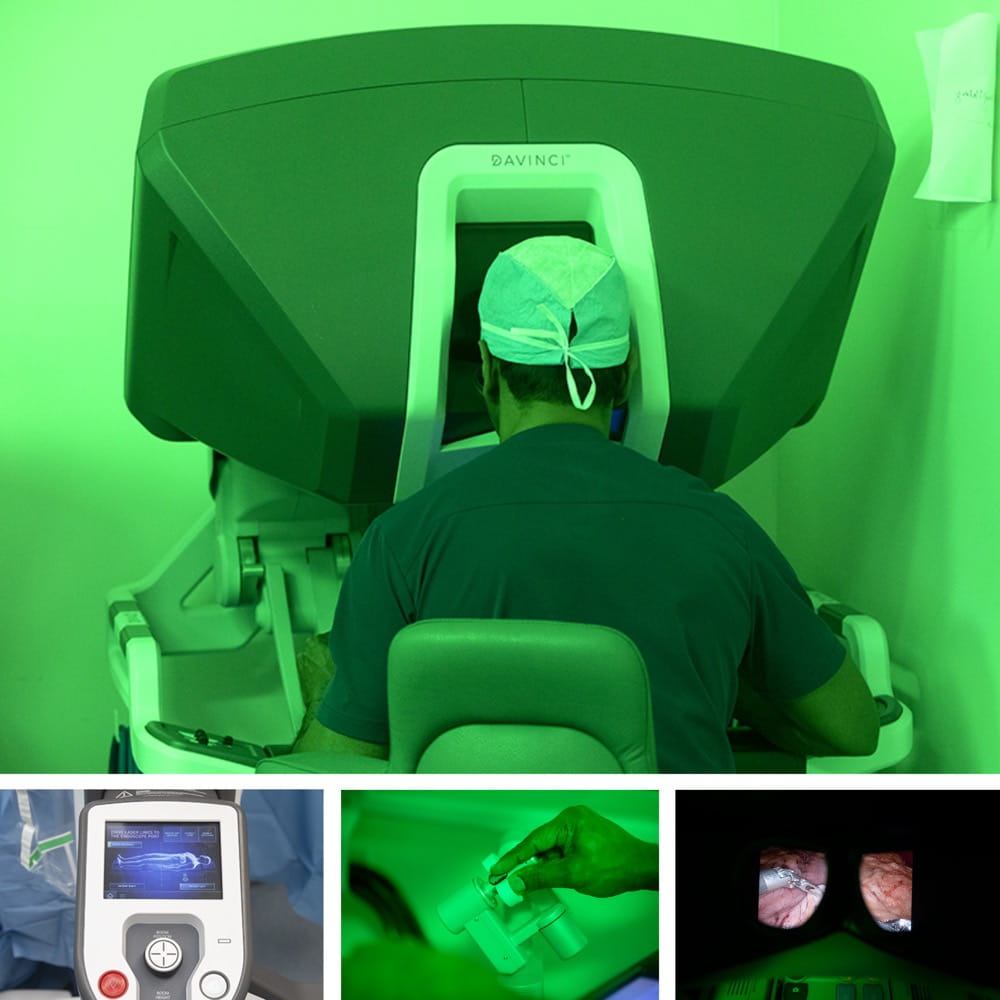 A collage of four photos. One is of surgeon at robotic terminal, one of the display on the robot itself, one of surgeons hands manipulating robot and one of what the surgeon is seeing as he works