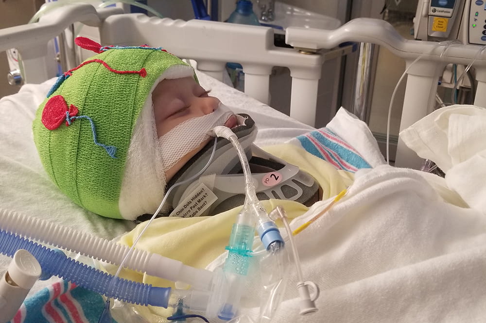 a baby lies in a hospital bed, tubes coming from his nose, his head encased in lime green bandages that are decorated with little balloon cutouts