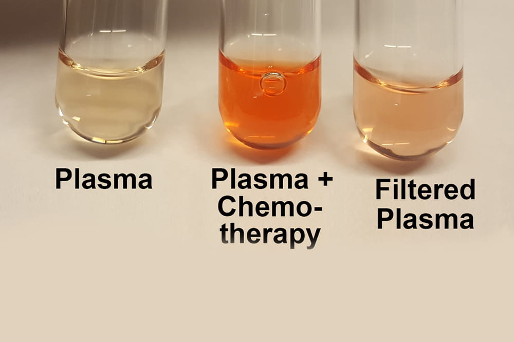 Three test tubes are pictured, the first with plasma, the second with plasma and chemotherapy, and the third with the filtered plasma. Modified from Figure 4d of the Motamarry et al article in Cancers under an open access Creative Common CC BY license.