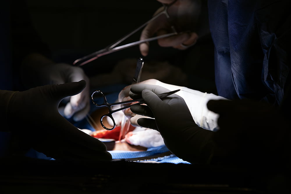 A surgical instrument is passed during a kidney transplant. Photograph by Sarah Pack.