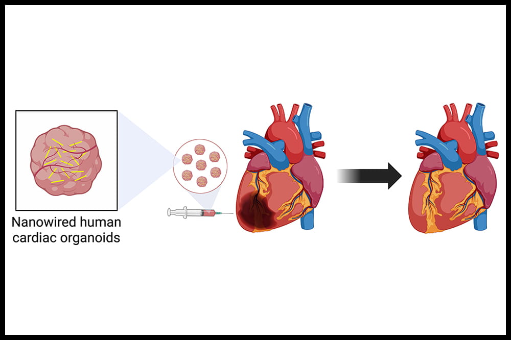 Nanowired human cardiac organoids for heart repair. Image created by Ryan Barrs using BioRender.